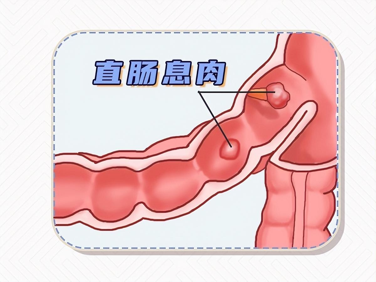 产后半个月出现鲜红血，原因、处理与关注