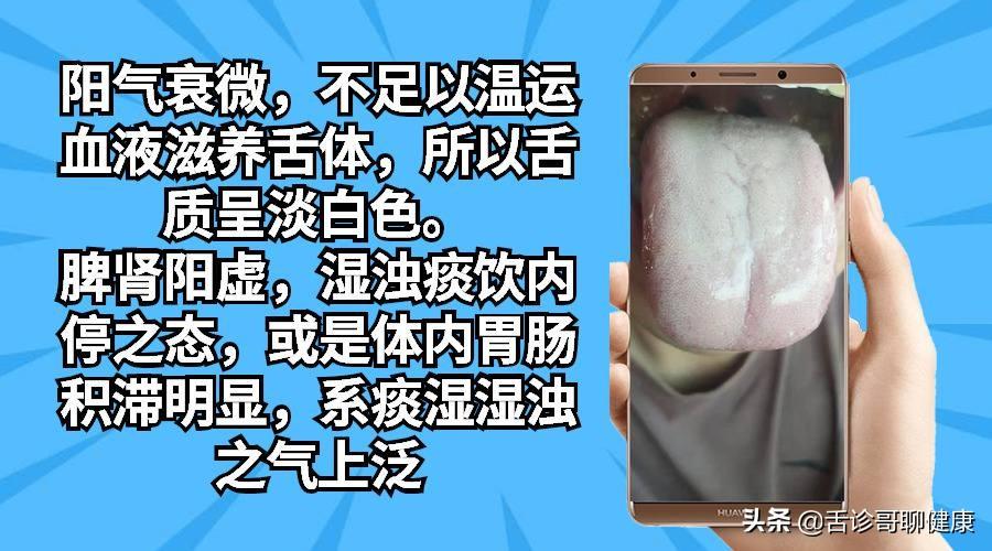 婴儿出虚汗，三个月宝宝的健康关注与应对方法